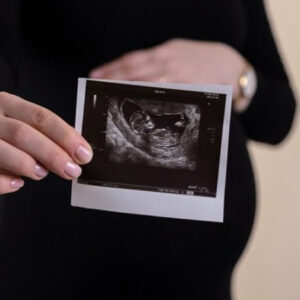 when is the best time to get a 3d ultrasound